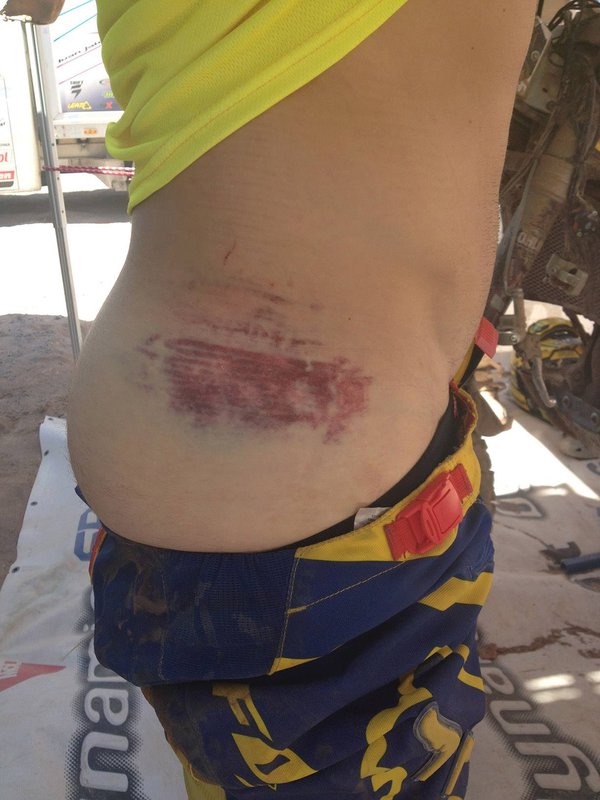 Dakar 2014 – 8. etapa - Števo Svitko - zranenie z pádu v 7. etape